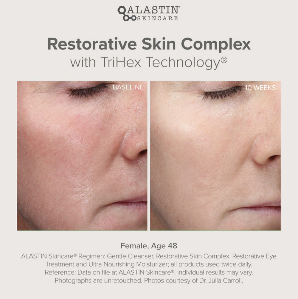 Skic Complex Restorative Skin Complex with TriHex+ 29ml – The Clinic